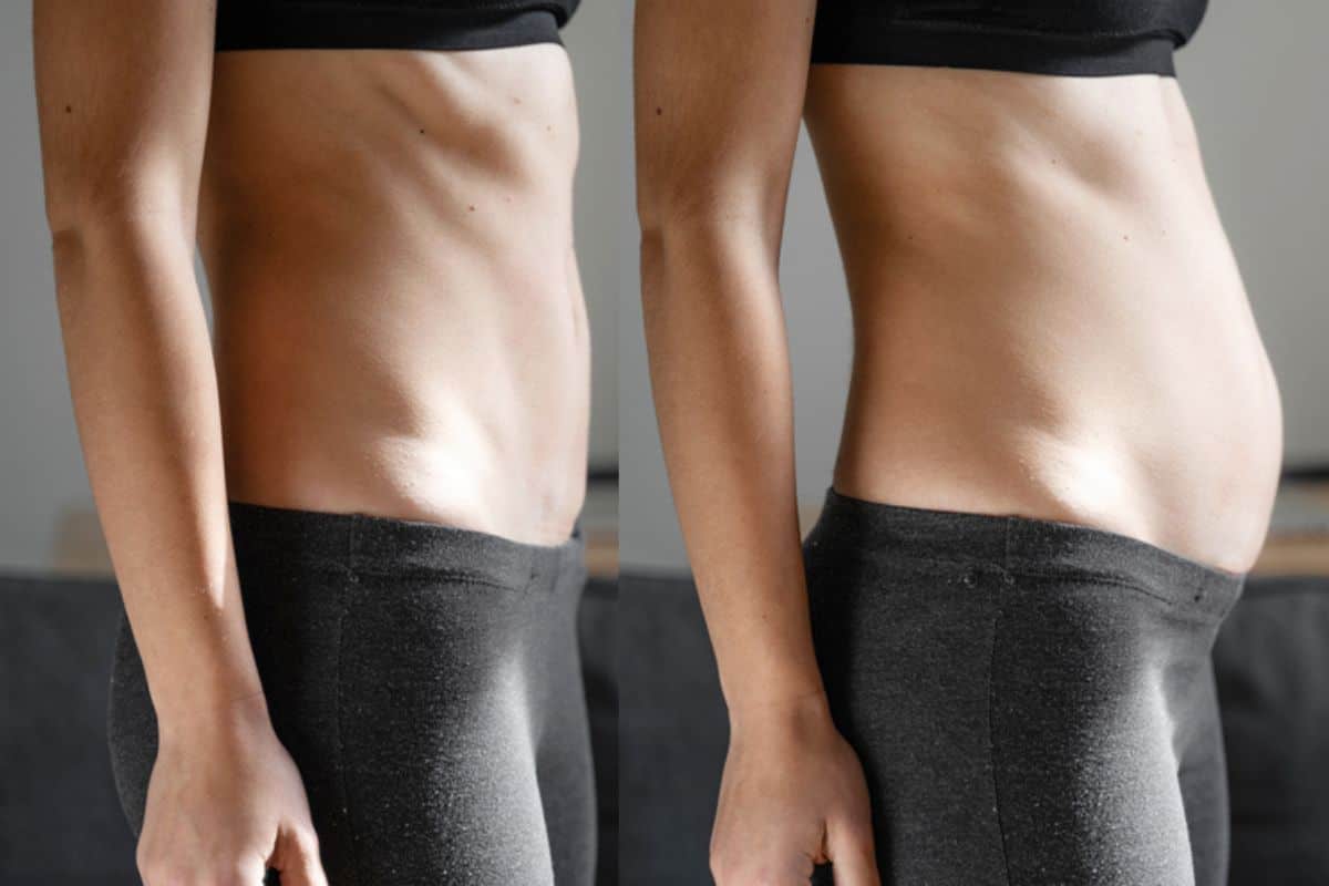 How long does diastasis recti take to improve Runcorn?