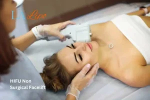 Woman having Hi-Fu to reduce wrinkles Runcorn.
