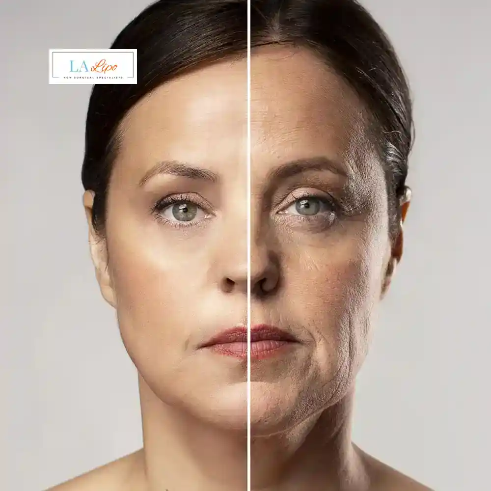 How Can You Tell If Non-Surgical Skin Tightening Is Right for You Runcorn?