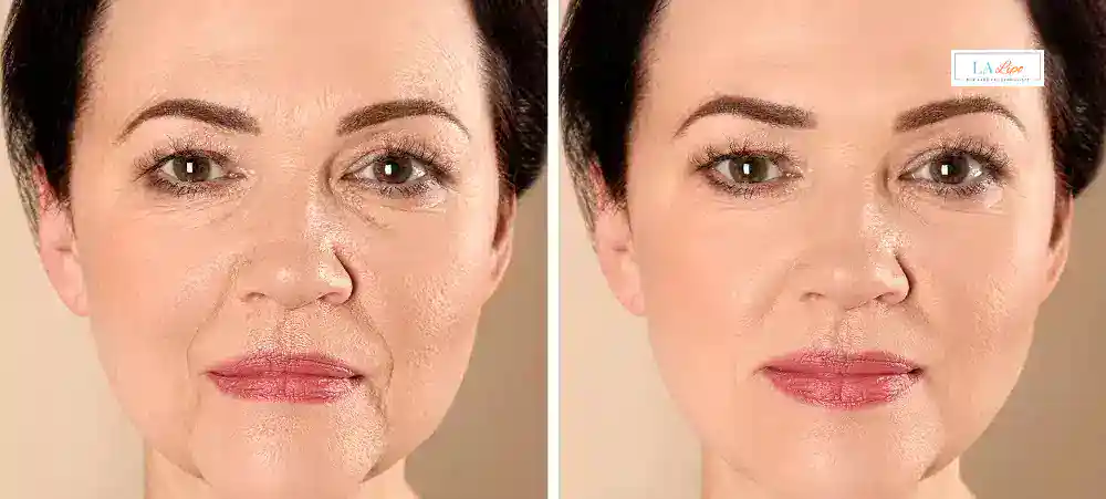 Why Aren’t My Skincare Products Making My Sagging Skin Look Firmer Runcorn?