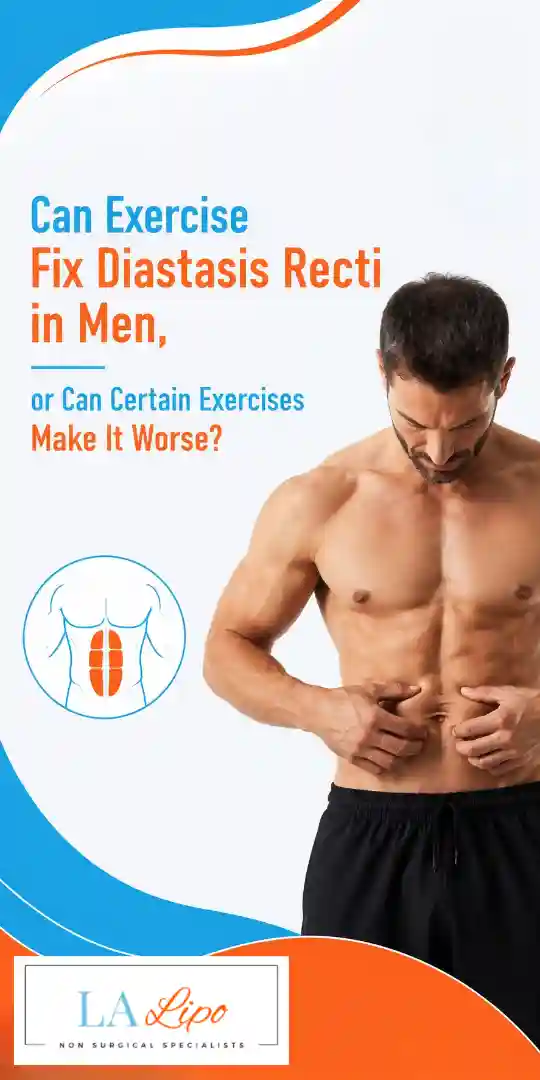 Can Exercise Fix Diastasis Recti in Men, or Can Certain Exercises Make It Worse Runcorn?